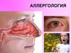 Аллергология. Аллергические заболевания