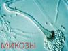 Микозы. Кератомикозы