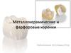 Металлокерамические и фарфоровые коронки