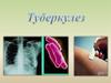 Туберкулез бактериялары