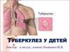 Туберкулез у детей