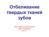Отбеливание твердых тканей зубов