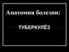 Анатомия болезни. Туберкулёз