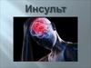 Инсульт. Острое нарушение мозгового  кровообращения