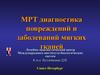 МРТ диагностика повреждений и заболеваний мягких тканей