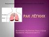 Рак лёгких