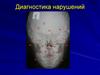 Диагностика нарушений