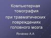 Компьютерная томография при травматических повреждениях головного мозга