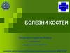 Болезни костей