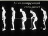 Анкилозирующий спондилит