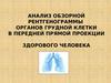 Анализ обзорной рентгенограммы органов грудной клетки в передней прямой проекции