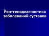 Рентгенодиагностика заболеваний суставов. Классификация заболеваний суставов