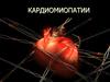 Миокардиты и кардиомиопатии