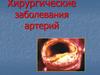 Хирургические заболевания артерий