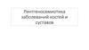 Рентгеносемиотика заболеваний костей и суставов