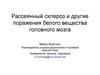 Рассеянный склероз и другие поражения белого вещества головного мозга