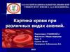 Картина крови при различных видах анемий
