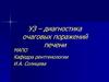 УЗ – диагностика очаговых поражений печени