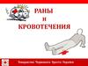 Закрытая рана, внутреннее кровотечение. Повреждение мягких тканей и органов при неповреждённой коже