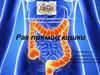 Рак прямой кишки