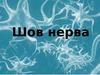 Шов нерва. Регенерация нерва. Неврома