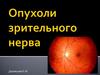 Опухоли зрительного нерва