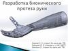 Разработка бионического протеза руки