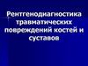 Рентгенодиагностика травматических повреждений костей и суставов