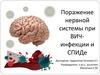 Поражение нервной системы при ВИЧ-инфекции и СПИДе