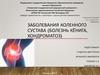 Заболевания коленного сустава (болезнь Кёнига, хондроматоз)