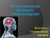 Острое нарушение мозгового кровообращения