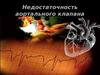 Недостаточность аортального клапана