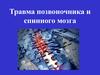 Травма позвоночника и спинного мозга