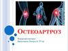 Остеоартроз. Факторы риска остеоарторза