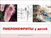 Пиелонефриты у детей