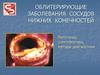 Облитерирующие заболевания сосудов нижних конечностей. Патогенез, симптоматика, методы диагностики