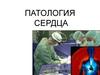Патология сердца