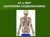 КТ и МРТ анатомия позвоночника