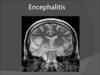Encephalitis