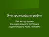 Электроэнцефалография, как метод оценки функционального состояния коры большого мозга человека
