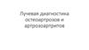 Лучевая диагностика остеоартрозов и артрозоартритов
