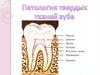Патология твердых тканей зуба