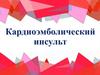 Кардиоэмболический инсульт