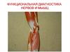 Функциональная диагностика нервов и мышц