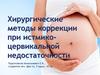Хирургические методы коррекции при истмикоцервикальной недостаточности
