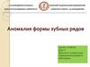 Аномалия формы зубных рядов