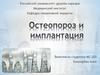 Остеопороз и имплантация