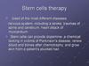 Stem cells therapy