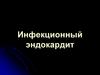 Инфекционный эндокардит
