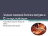 Лечение язвенной болезни желудка и 12-перстной кишки